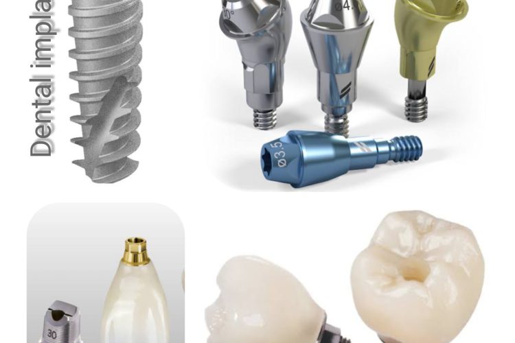 Looking For Dental Implants Near Me